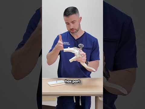 Knee Replacement Surgery Video