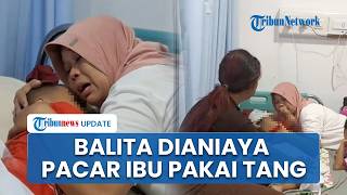 Kronologi Balita 2,5 Tahun Dianiaya Pacar Ibu Pakai Tang di Karawang, Bermula saat Menginap di Hotel