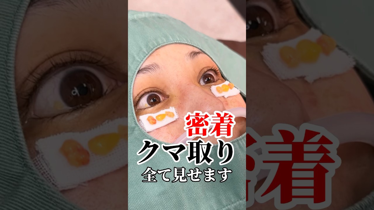 Youtubeのサムネイル