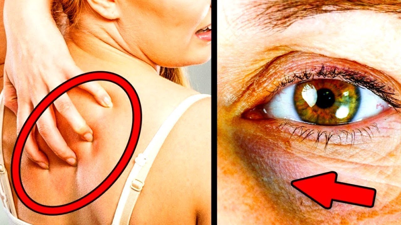 12 Signes qui Montrent que tu manges Trop de Sucre