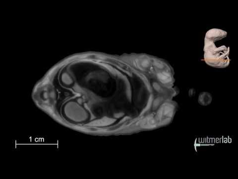 Visible Interactive Opossum - transverse slice movie of a µCT-scanned opossum joey