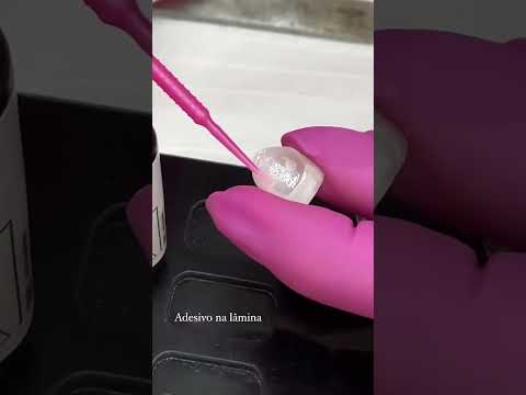 DETALHES QUE FAZEM TODO A DIFERENÇA, Odontologia em alta performance, com Dr Gustavo Caetano.