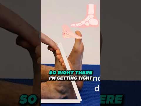 What not to do with plantar fasciitis What is plantar fasciitis