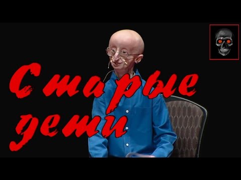 Растяжка ног тазобедренный сустав Болеутоляющее при шейном остеохондрозе