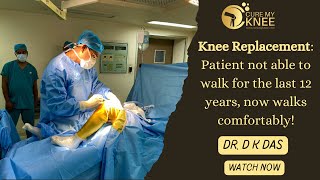 Knee Replacement Surgery Recovery by Dr DK Das @CureMyKnee #kneereplacementrecovery #patientreview