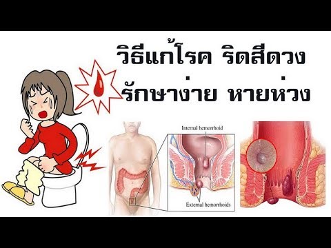 การเพิ่มสมาชิกนวดก่อนและหลัง วิธีการได้รับ taumkraft แรง