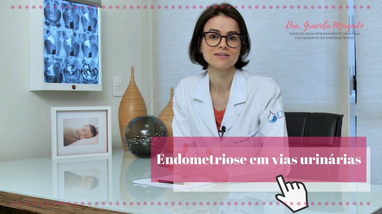 Endometriose em vias urinárias