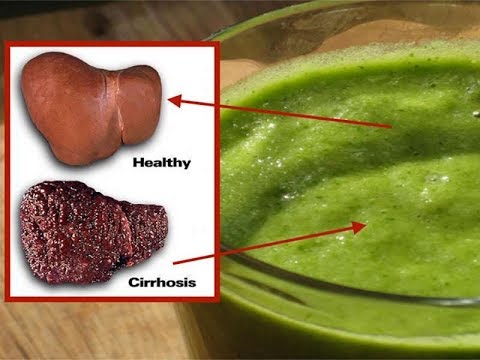 Ja receta natyrale që eliminon dhjamin e mëlçisë në vetëm pak ditë!