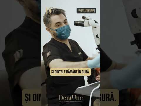 Crezi că dinții nu mai pot fi salvați? Uite acest caz