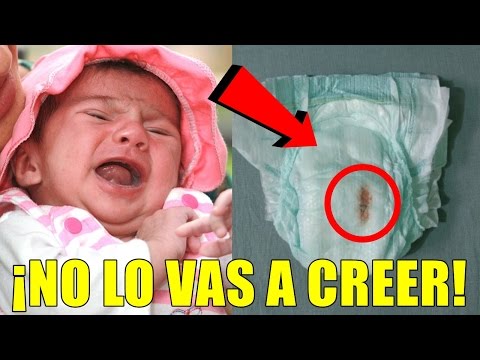 Su bebé no paraba de llorar, cuando la mamá le cambia el pañal descubre algo terrible Video