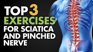 Top 3 Exercises for Sciatica and Pinched Nerve