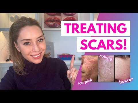 How To Treat Scars: Flat, Depressed, Raised, and Keloids | Dr. Shereene Idriss