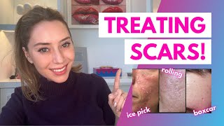 How To Treat Scars: Flat, Depressed, Raised, and Keloids | Dr. Shereene Idriss