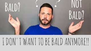 I Dont Want to be Bald Anymore!!
