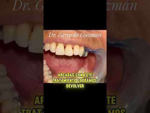 Gerardo Guzmán Gonzalez-100