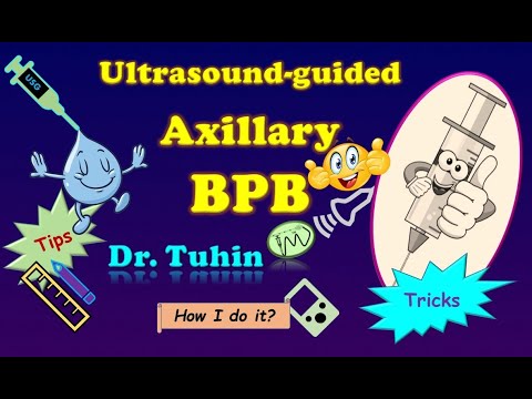 Tips & Tricks of Axillary Brachial Plexus Block | ultrasound| Perivascular | Perineural @DrTuhinM