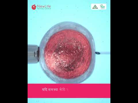 Did you know about these tests required before starting IVF.....These are....