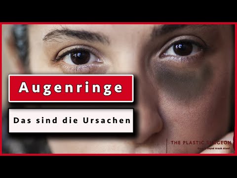 Was sind die URSACHEN für Augenringe und dunkle Augenschatten? Plastische Chirurgie | Dr. Alawi