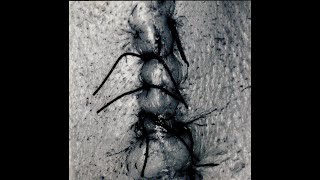 SCHEER - Sad Loved Girl [audio]