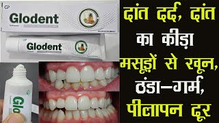 Glodent Toothpaste | दांत दर्द, दांत का कीड़ा, मसूड़ों से खून आना, ठंडा-गर्म लगना, पीलापन दूर होगा