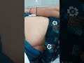 Female Hip Injection Video