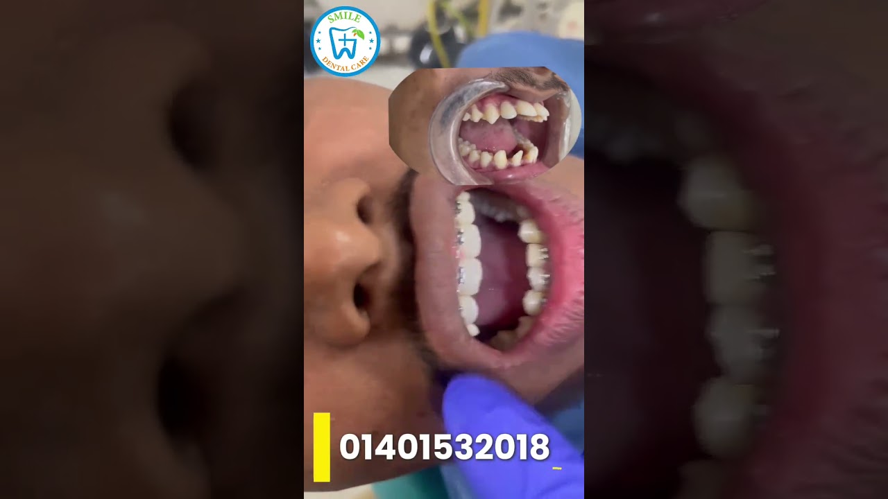 আশ্রম থেকে সুন্দর হাসির অপেক্ষায় ছিলাম, এখন তা সত্যি হলো। - ভিডিও পর্যালোচনা