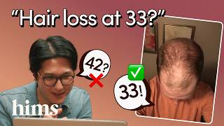  Receding Hairlines by Age: Guess Men’s Age Based