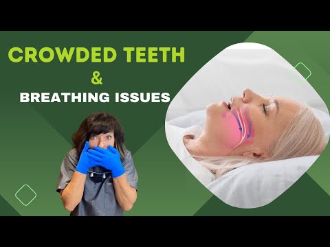 Crowded Teeth & Breathing Issues