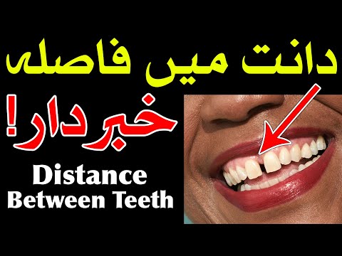 Dant Me Fasla ilm e Jafar Astrology دانت میں فاصلہ Distance Between Teeth Mehrban Ali ilm e Najoom