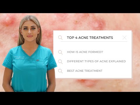 Top 4 Acne Treatments | All you need to know!