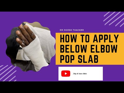 How to apply below elbow pop slab ( for wrist and hand fracture)/ sports injury/ accidents/fall