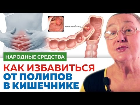 Как лечить солью коленный сустав Вальгусная установка в коленных суставах