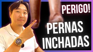 VERY Swollen LEGS. WHAT CAN IT BE?