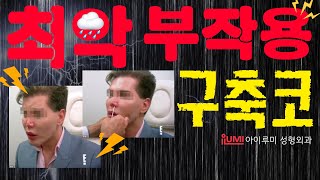 #구축코 ???? 최악의 부작용2 - 대체 어느정도로 심각해?.. #아이루미성형외과