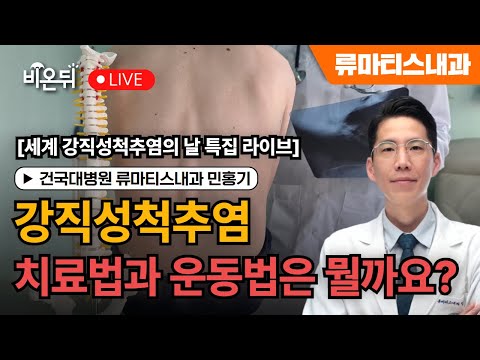 비온뒤 - 강직성척추염, 어떻게 치료하고 운동할까요? 