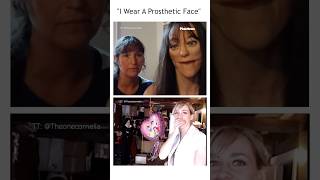 "I Wear A Prosthetic Face" #shorts #facialsurgery #prosthetics