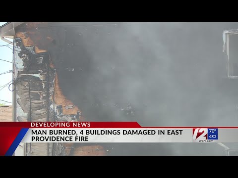East Providence garage fire spreads to neighboring homes; man suffers severe burns