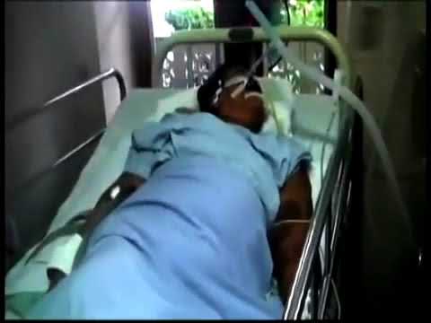 1. Brainstem Myoclonus Myoclonus Spring Video Atlas - YouTube