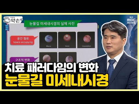치료 패러다임의 변화, 눈물길 미세내시경 ['눈물 흘림' 진단과 치료 ⑩] | 메디컬 약손