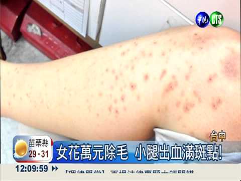小腿除毛留疤! 女被譏"紅豆腿"