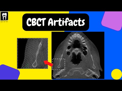 Artefakty CBCT | Podstawowe zasady interpretacji zdjęć CBCT | Tomografia stożkowa CBCT