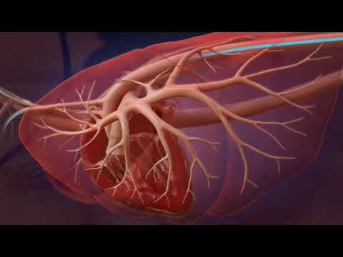 Heartworm Life Cycle for Professionals