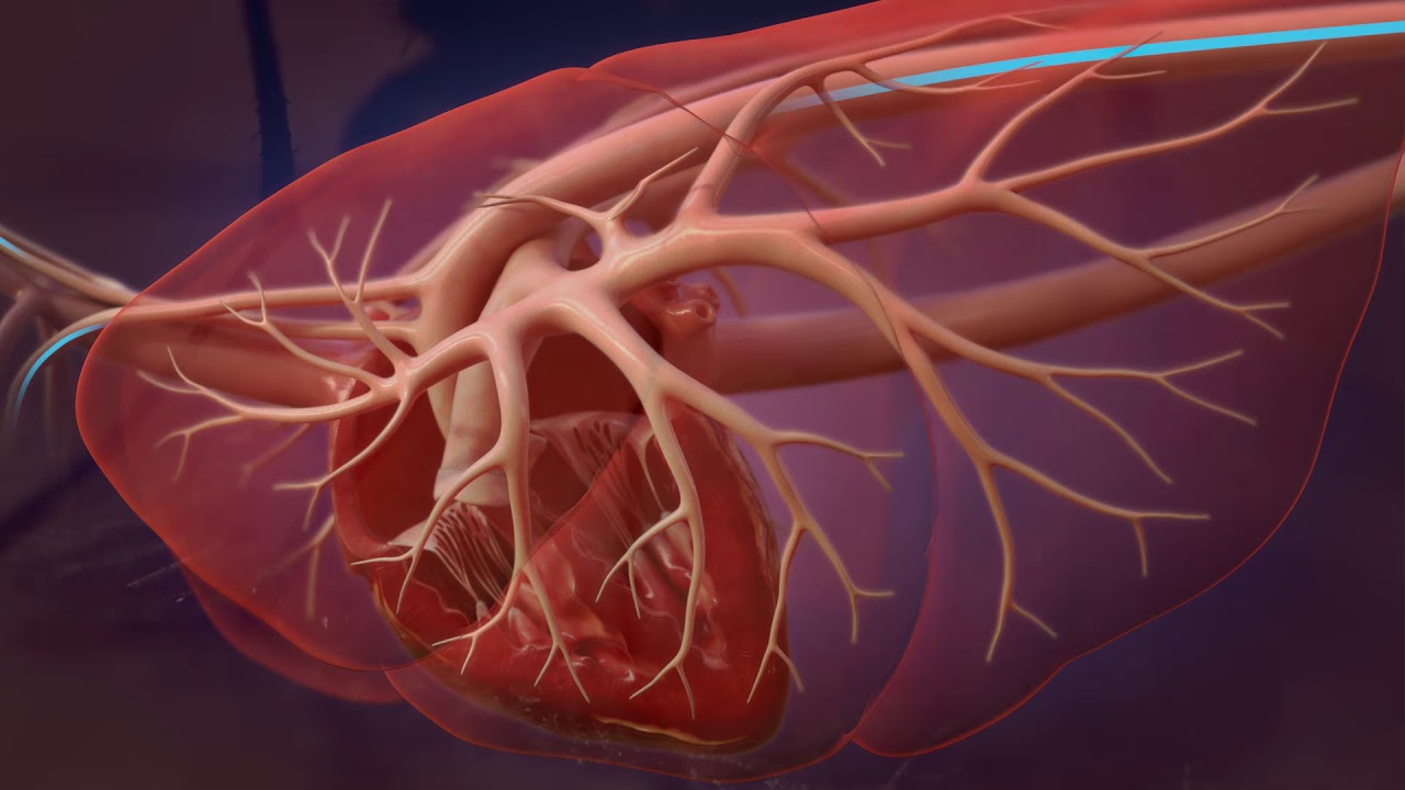 Heartworm Life Cycle for Professionals - YouTube