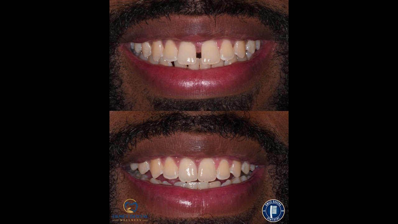 Smile Gallery Video 8