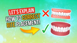 What Is A Correct Bite?! | Correcting Overbites, Underbites, Buck Teeth & MORE!