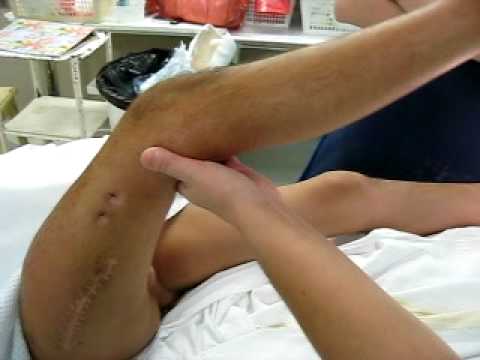 Trental con il mal di schiena Medicina cinese per comune
