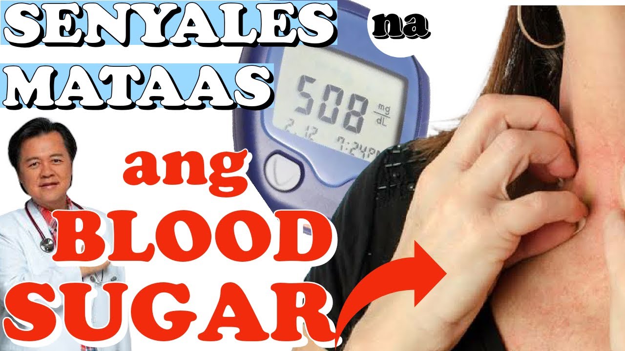 Senyales na Mataas ang Iyong Blood Sugar - By Doc Willie Ong #1090