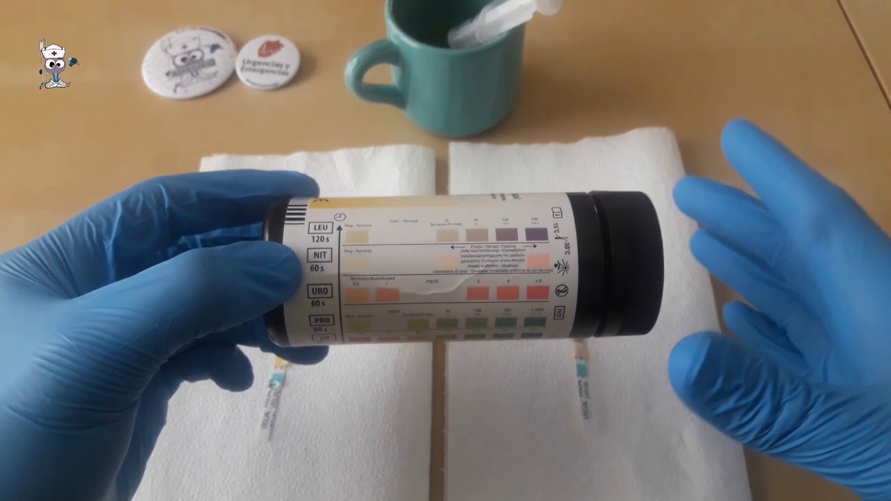 👌 INTERPRETACIÓN TIRA DE ORINA