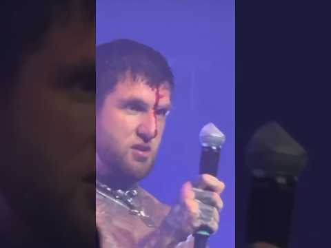 Alex Terrible Loses It – Bloody Mic Self-Destruction!