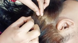 🌙✨Relaxing Scalp Check & Scalp Treatment ASMR / Tingles, #sleep #asmr#tingles